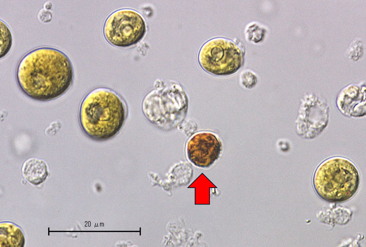 エダコモンサンゴの褐虫藻（顕微鏡写真）。赤矢印で示した褐虫藻は、高水温のストレスを受けて梅干しのように縮んで小さくなったもの＝鈴木款・静岡大学名誉教授提供